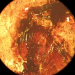 zuglio nodulo-di-ambra